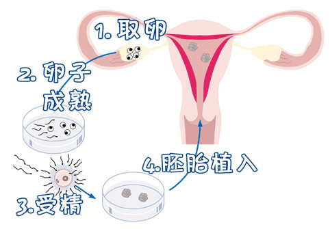 显微操作